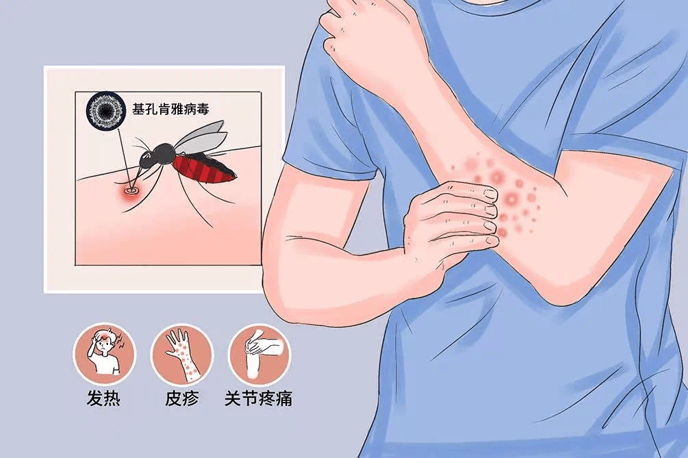 带毒的蚊子引发这“热带病”，南方网友加班加点看科普