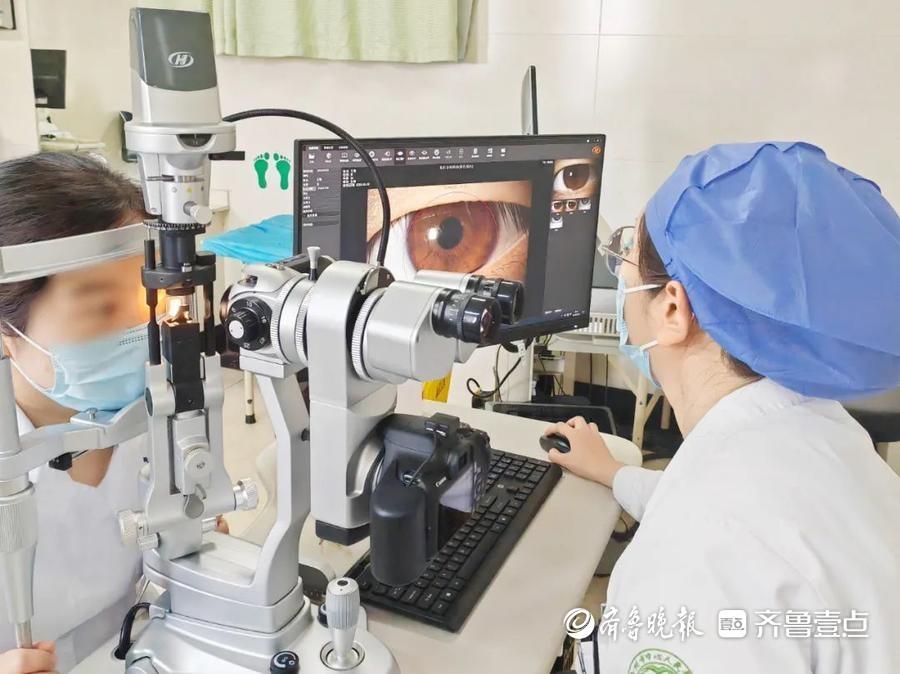干眼检测仪 OptiLight强脉冲光干眼治疗仪开启治疗新篇