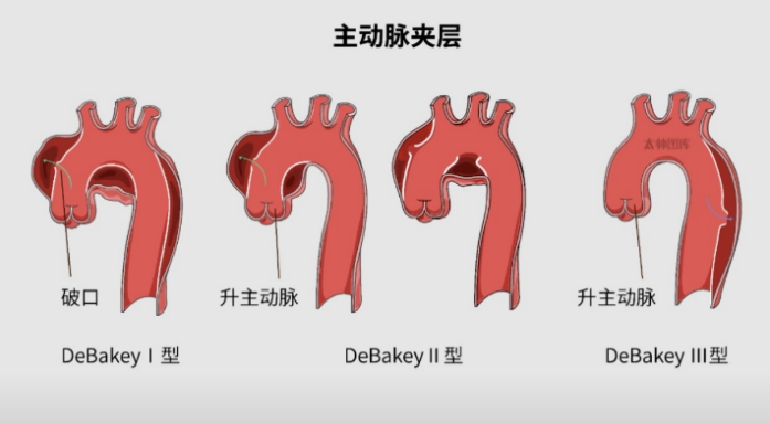 在举目无亲的城市，36天抢救闯过数个危险关口
