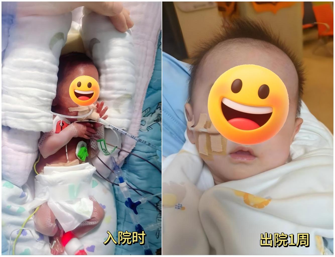 小叶医探 | 出生时体重仅475克，24周早产宝宝如今迎来“新生”