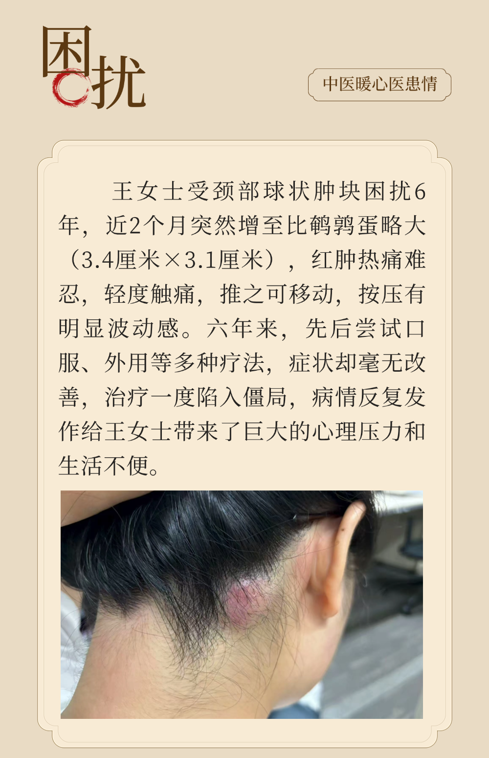 顽疾六年！菏泽市妇幼保健院中医辨证，助患者摆脱颈部肿块困扰
